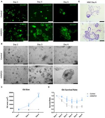 R-Spondin 1 (RSPO1) Increases Mouse Intestinal Organoid Unit Size and <mark class="highlighted">Survival in vitro</mark> and Improves Tissue-Engineered Small Intestine Formation in vivo